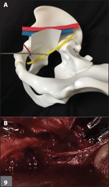 obturator nerve