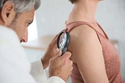 Melanoma Skin Cancer Detection