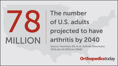 Arthritis graphic